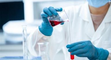 Deprem sonrası salgın hastalıkları önlemenin yolları