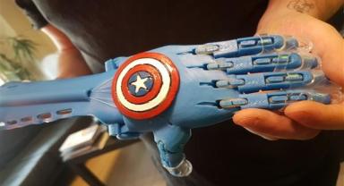 Alternatif Bank ve Robotel Derneği, uzuv kaybı yaşayan çocuklar için el ele verdi