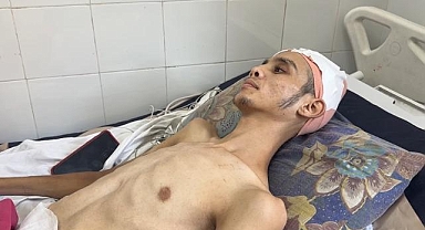 Gazze'de yardım almaya giderken başından vurulan Filistin halk oyunları dansçısı Ahmed'in hayatı karardı