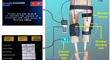 Yıldız Teknik Üniversitesi akademisyenleri otonom tümör protezi geliştirdi