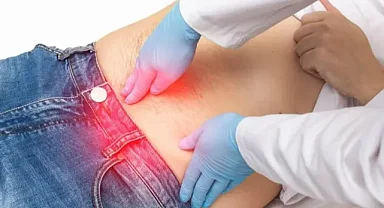 Kasık fıtığı tedavisinde hastaya özel yöntem uygulanabilir