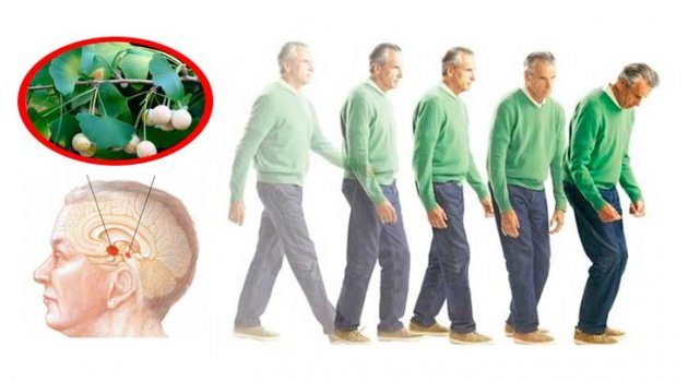 Sinsi İlerleyen Hastalık Parkinson